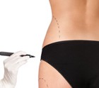 drsalomom-before-and-after-revised_011