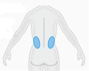 coolsculpting-miami-back